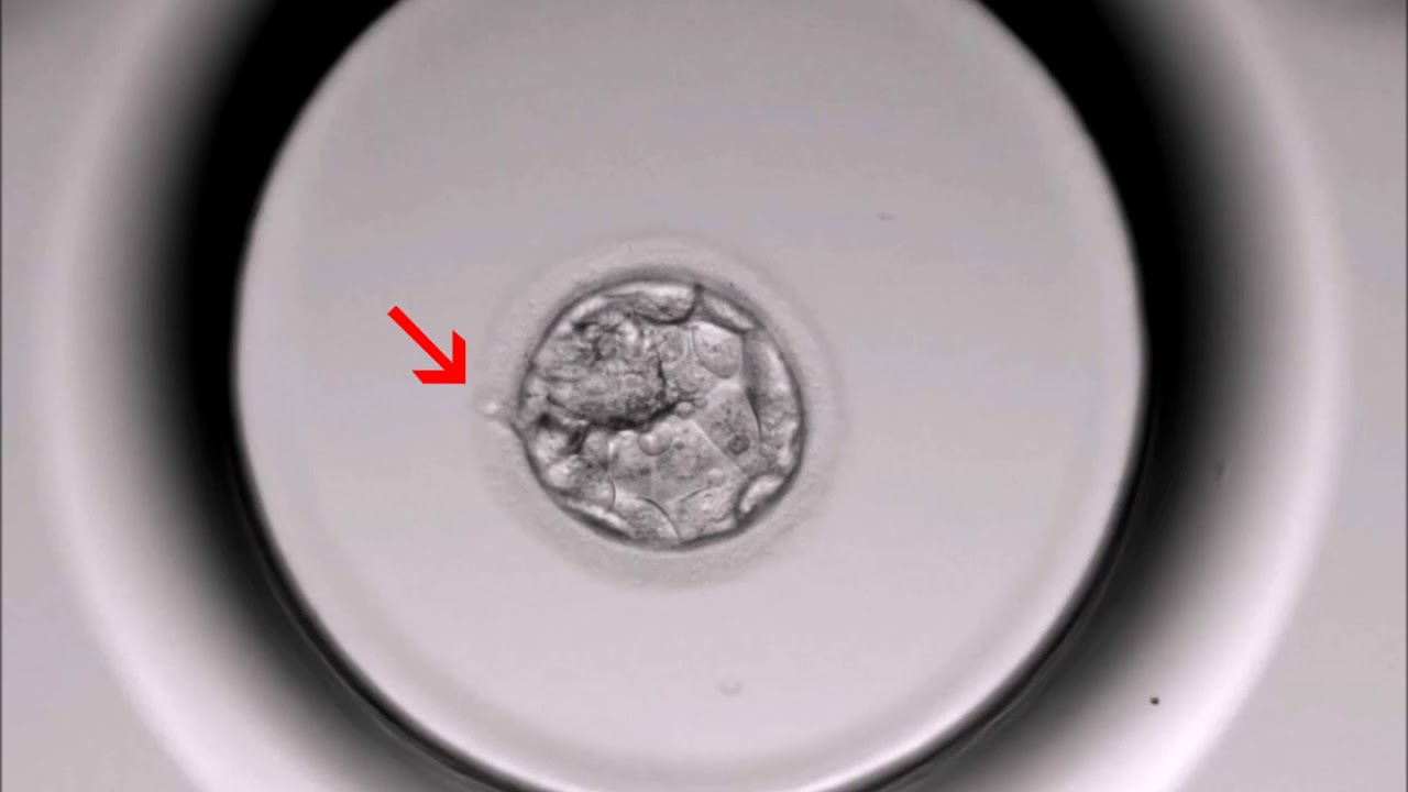 asistovaný hatching